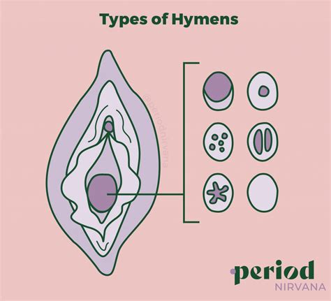 broken hymen|What Is a Hymen and What Does a Hymen Breaking。